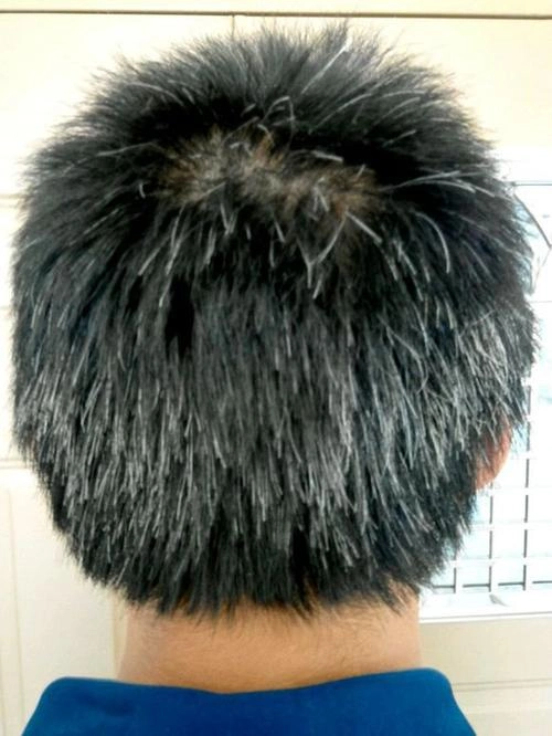 黑芝麻能使头发变黑有没有道理