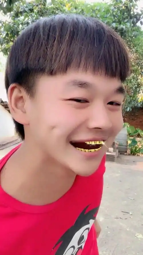 这金牙镶的没谁了