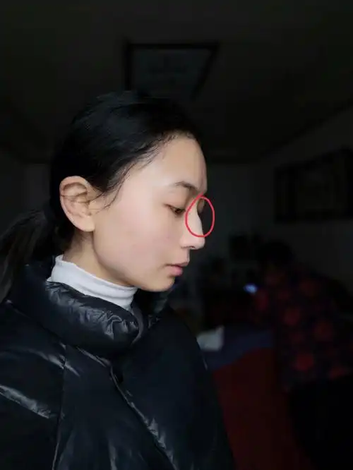 我大概不能和我的驼峰鼻和解了