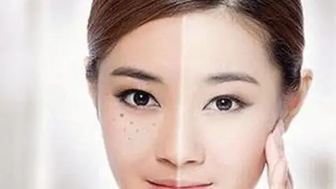 想要祛斑先去掉这些坏习惯