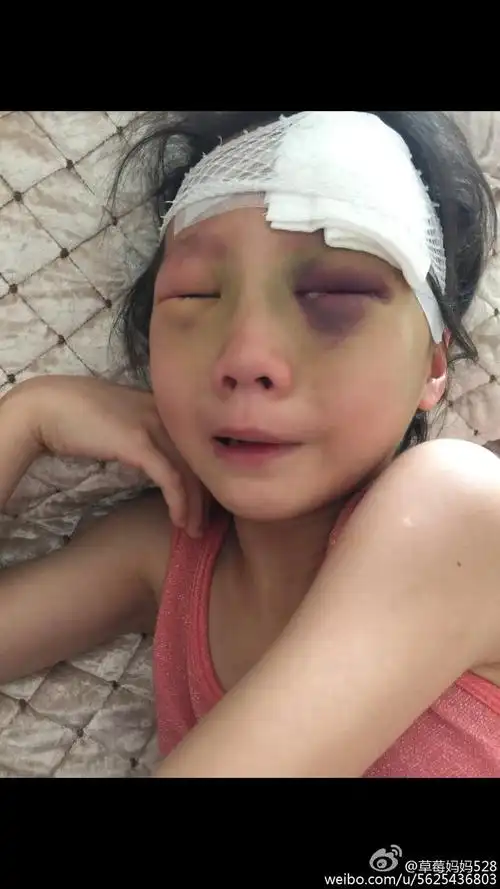 打人视频  http://v.youku.com/v_show/id_xmti1ntc4njmwma==.html