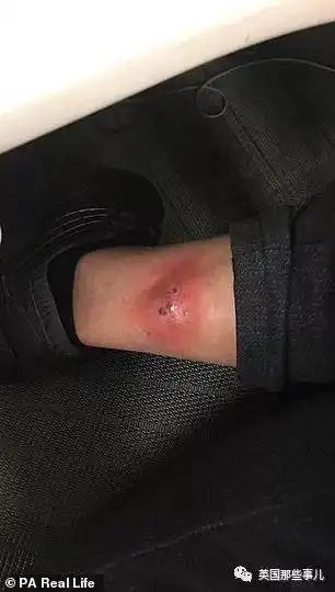 被蜘蛛咬了一口蜘蛛侠被蜘蛛咬了一口