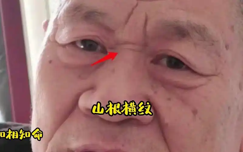面相学山根有横纹的人代表什么意思_山根有横纹如何化解_出轨面相山根
