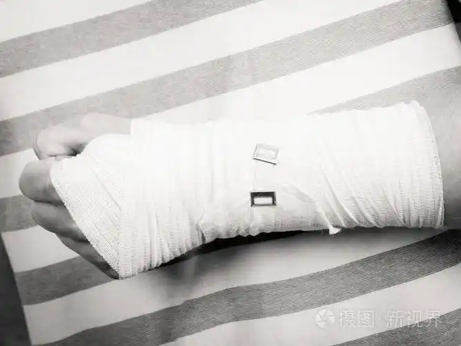 照片 骨折与脱位的概念.部分身体男性用绷带的手.