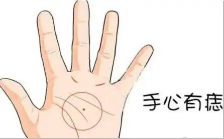 掌心痣是福是祸看完这三点再决定要不要点痣
