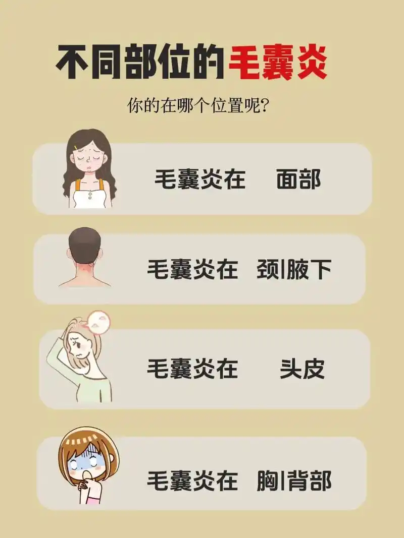 对比自己!不同部位长毛囊炎的原因