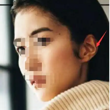 反骨耳:耳朵中轮处外翻,这种耳型一般耳垂较小,生有这种耳相的人性格