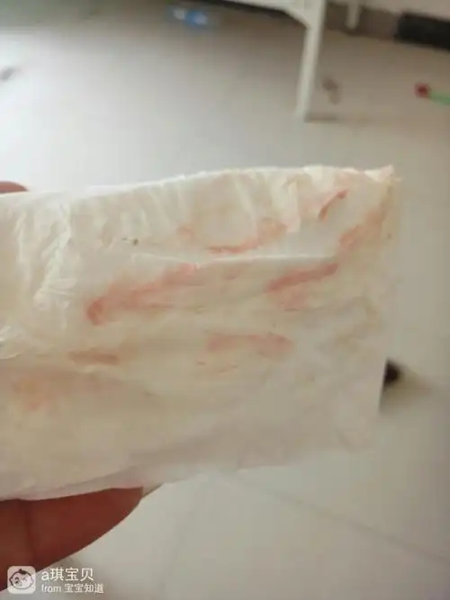 排卵期会出血吗?