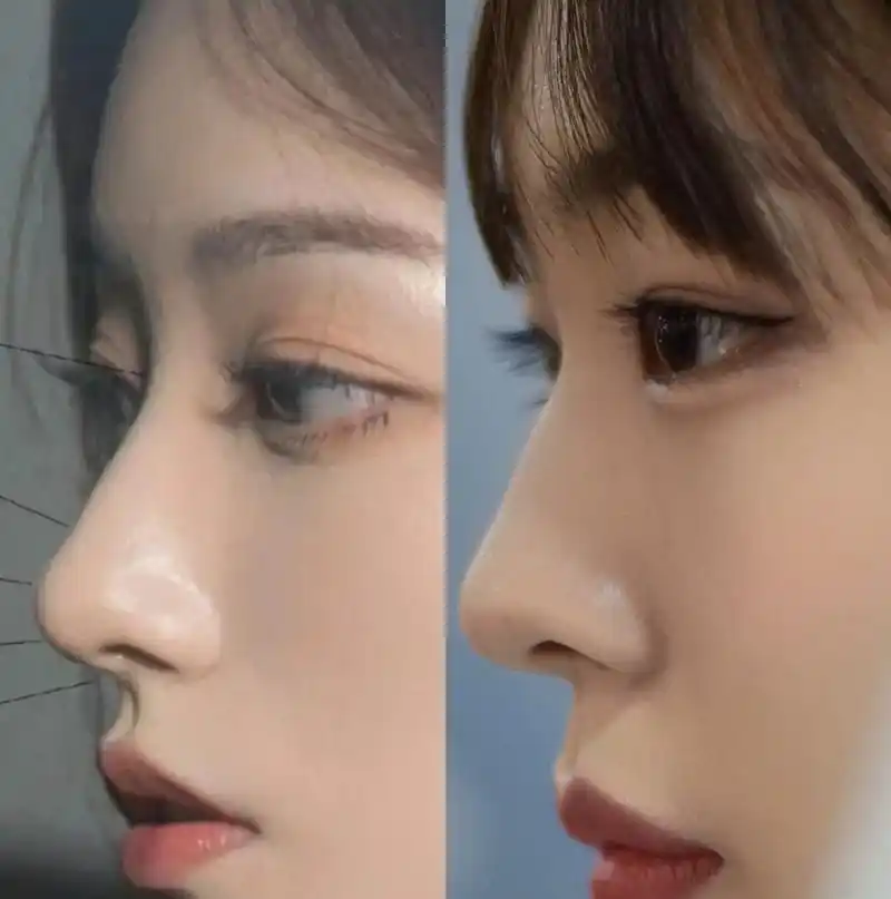 女生好看的4种鼻型:水滴鼻很加分,艺术鼻颜值高,中一个就很美