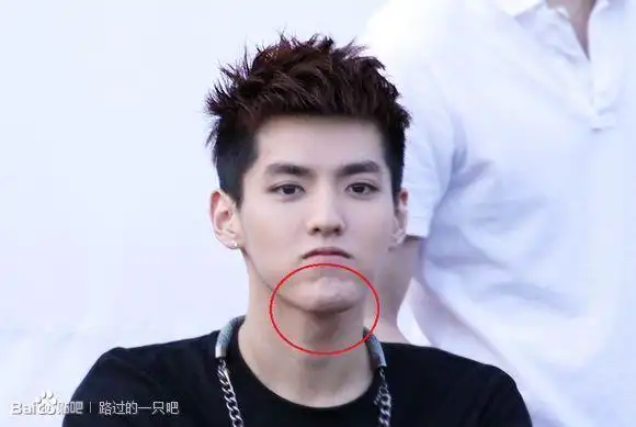 吴亦凡整容前后照片 吴亦凡真的整容了吗?