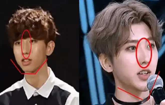 蔡徐坤成名前照片曝光,在韩国双膝下跪太卑微,整容前后容貌大变_前辈