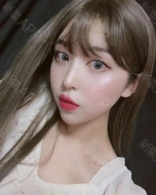 玻尿酸填充卧蚕