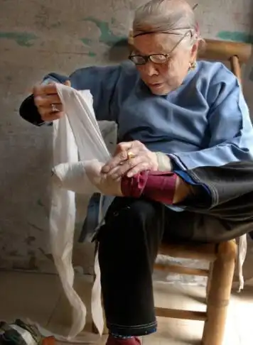 重庆百岁老太缠足近百年裹脚布拆下来有一米五长病态审美