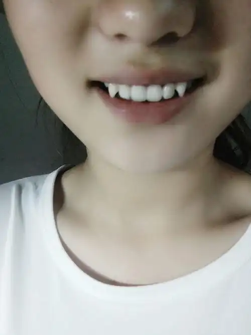 有虎牙是一种怎样的体验?