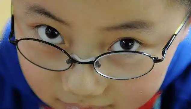 眼睛近视多少度会瞎 眼睛近视多少度会瞎眼