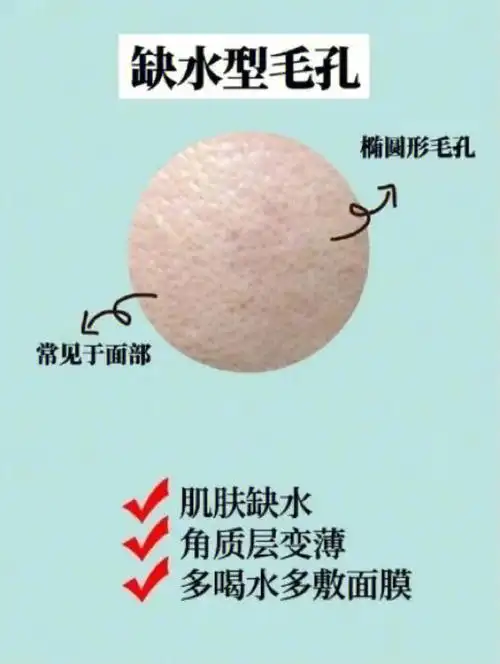 毛孔粗大的原因