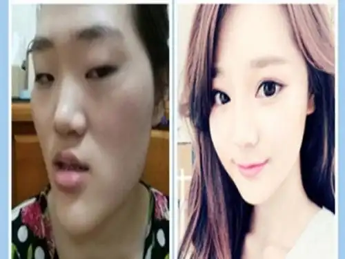 虽然我们看到过许多韩国人整容前后的震撼对比图,但是这15张图片又让