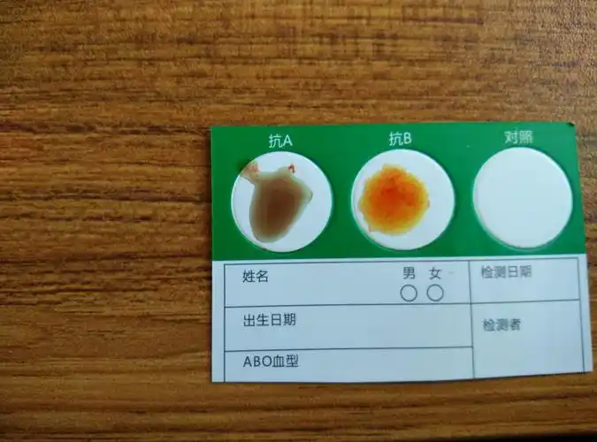 这是什么血型?感觉抗b的凝集,抗a的不明显