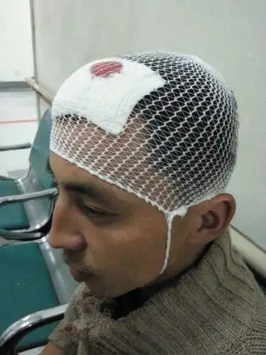 这样的梦是好还是坏,想要知道梦见头被别人打的流血是什么意思,就跟着