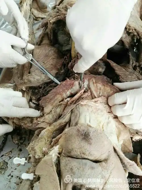 今天,在壅教授和林老师的指导下,在成都医学院搞了一天的尸体解剖.