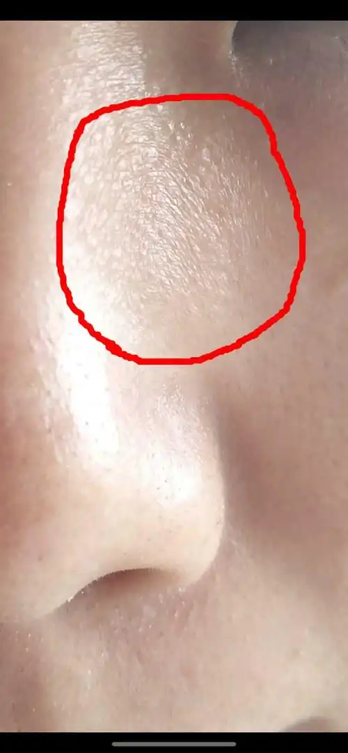 皮肤干燥紧绷怎么办