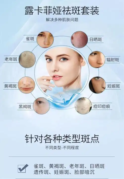 美白淡斑护肤品哪个牌子好淡斑祛斑最有效的方法在这里