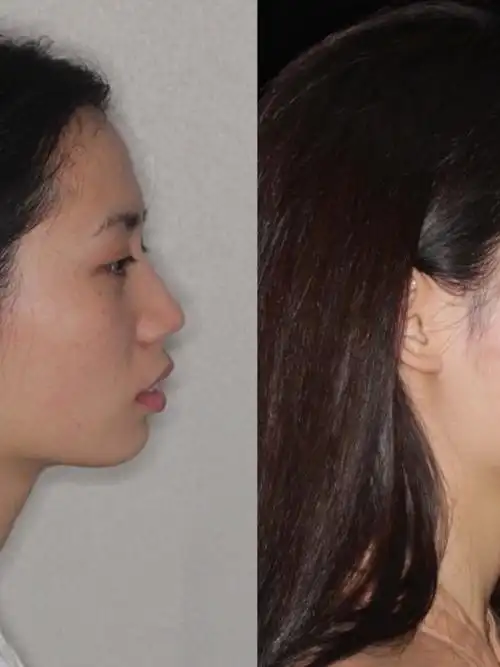 原相机拍摄的前后对比图,看的更真实一点!