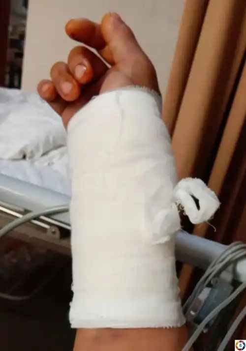 女儿患重病,父亲在去医院路上被撞伤后哭了:"我倒下她咋办?