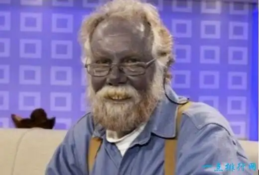 蓝种人的形成之谜