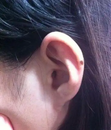 都说耳朵有痣看人生命运这种说法是真是假答案来了