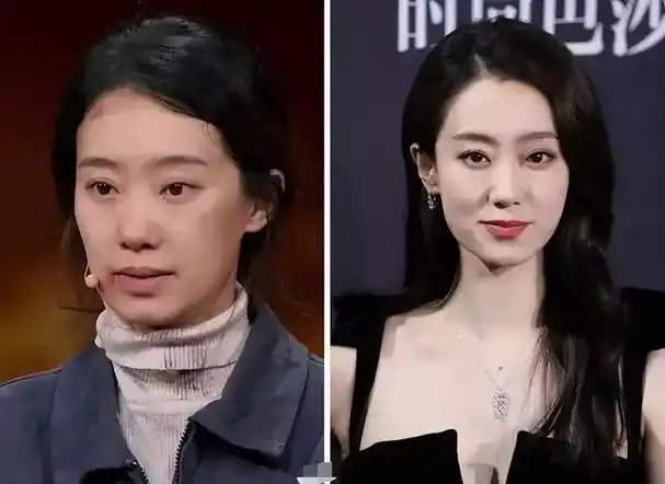 鼻子塌不可怕,面中凹才拉胯,显苦显凶还显老,许多女星深受其害