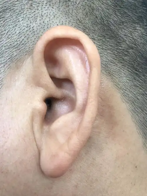 这个耳朵气色正常吗?可以看出身体有什么不对吗?