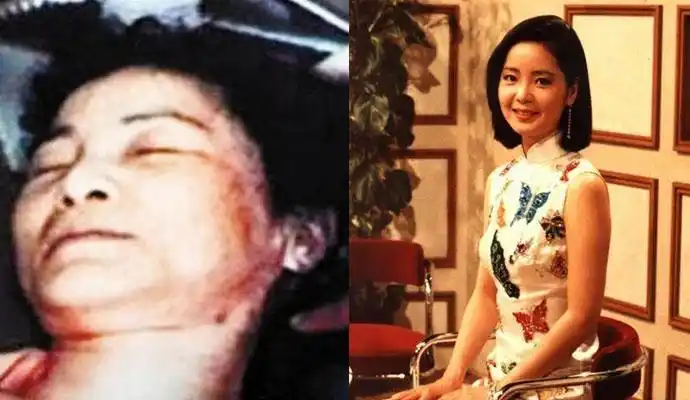 邓丽君哮喘病发后,邓丽君的男友保罗没有一点紧张,就像看陌生人一样