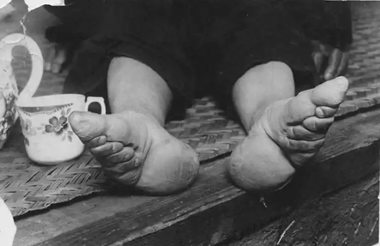 你们说缠足丑陋,人家说缠足美妙