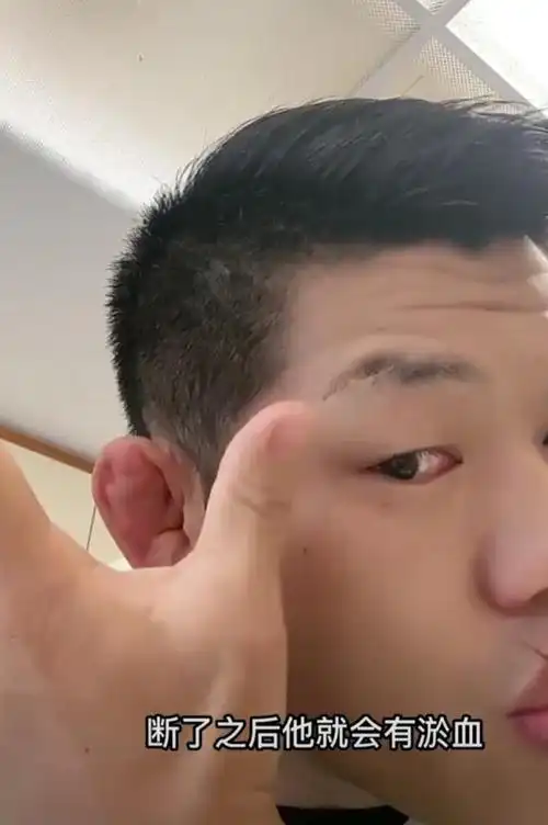 李景亮曝光耳朵特写让人叹服耳朵长得像饺子网友惹不起你