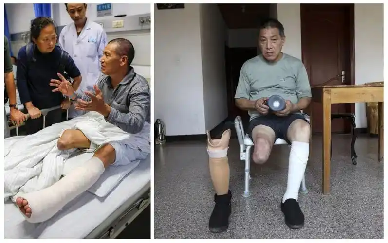 拼版照片:左图为2016年10月24日,姜水根在医院接受截肢手术后与探望