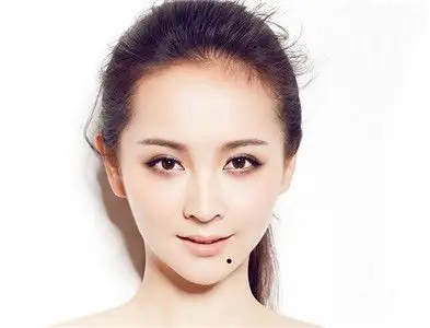脸上有美人痣的命运如何