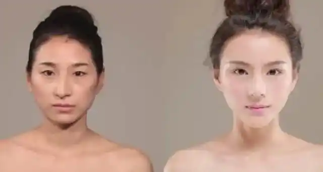 美白针有什么副作用吗