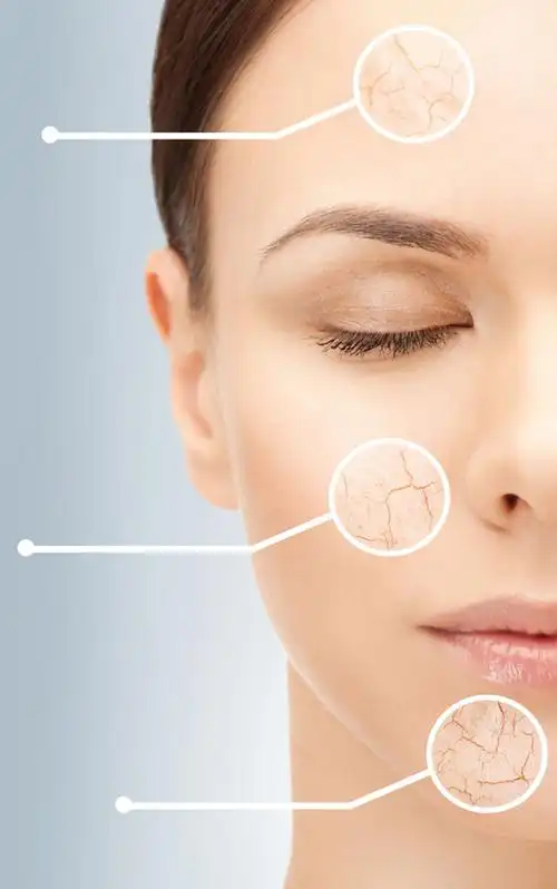 关键词:护肤品广告图片素材美容护肤皮肤保养皮肤干裂整容整形女性