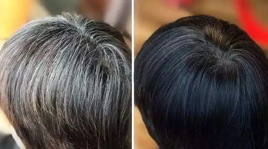 脱发者必备的白发变黑发土方