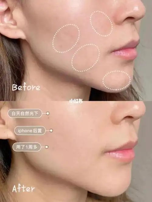 不管什么护肤产品都是需要坚持使用才能见到明显效果的坚持使用28天