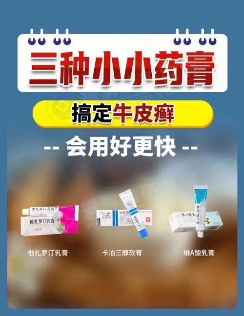 3种常用的药膏60用对剩好几个w60