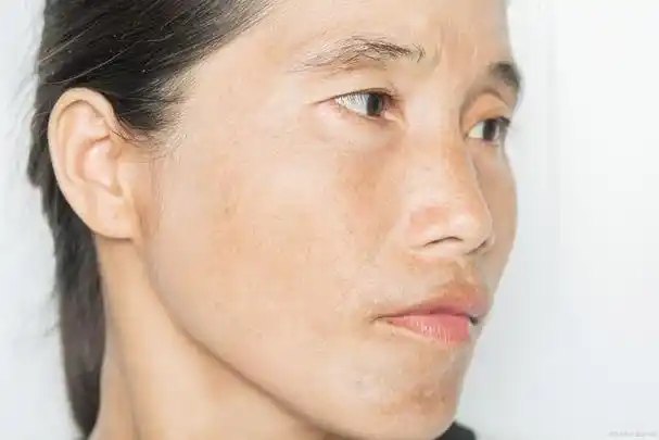 卸了妆是48岁,都是因为皮肤暗黄,不仅