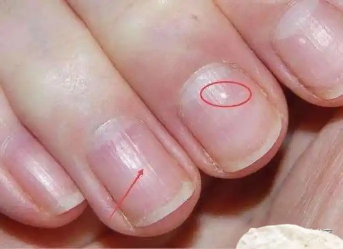 指甲盖望指甲盖知识分享