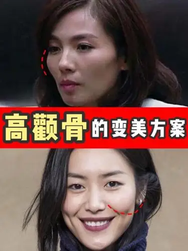 别再说高颧骨就是高级了,超模脸不是人人都有的,所谓的超模高级脸就像