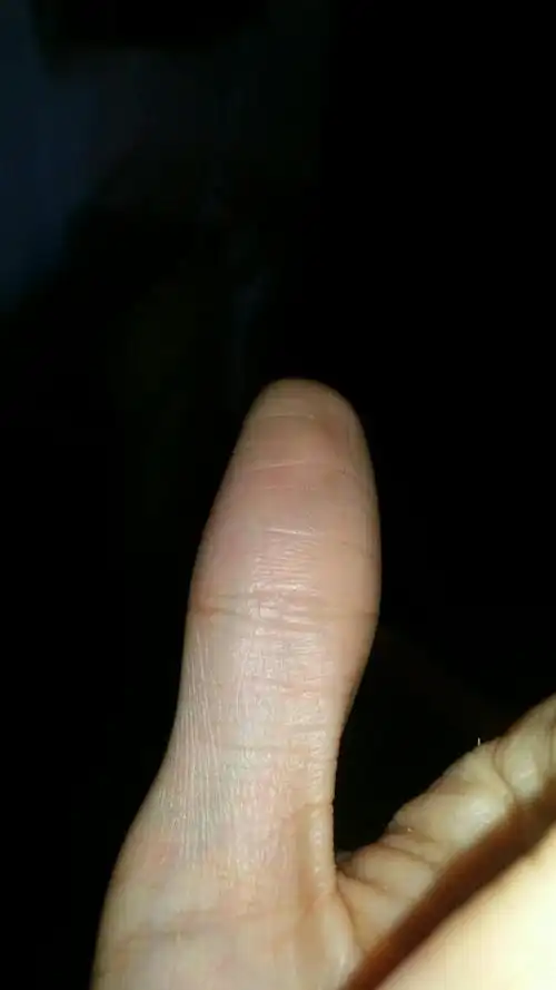 我大拇指这个纹路是不是手相里所说的"佛眼"或者"凤眼"啊?