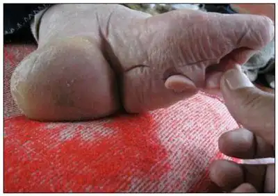 《裹脚》拼音/读音/英文/繁体