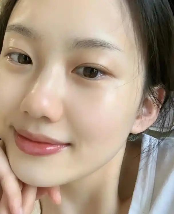 脸上"有斑"要怎么解决,学会做好3件事情,皮肤细腻还显年轻