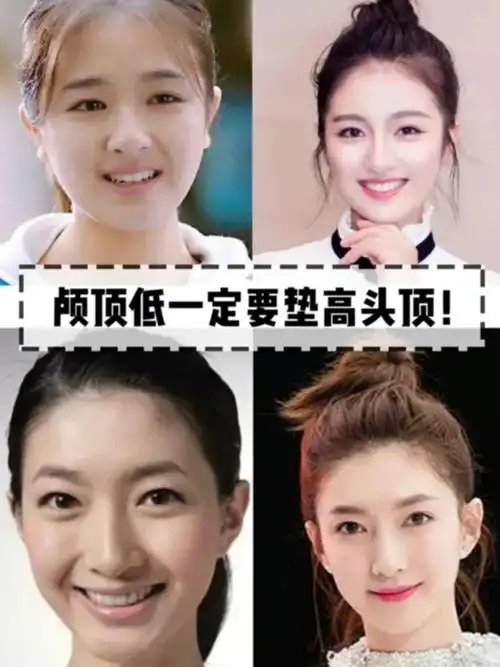 你脸大可能是颅顶低