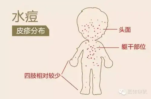 水泡疹,皮肤过敏症状,水泡疹图片大全_文秘苑图库